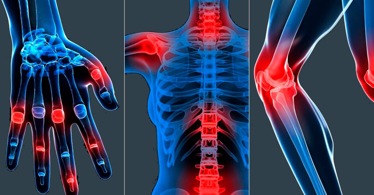 Indications d'utilisation de l'extrait de Boswellia en gélules
