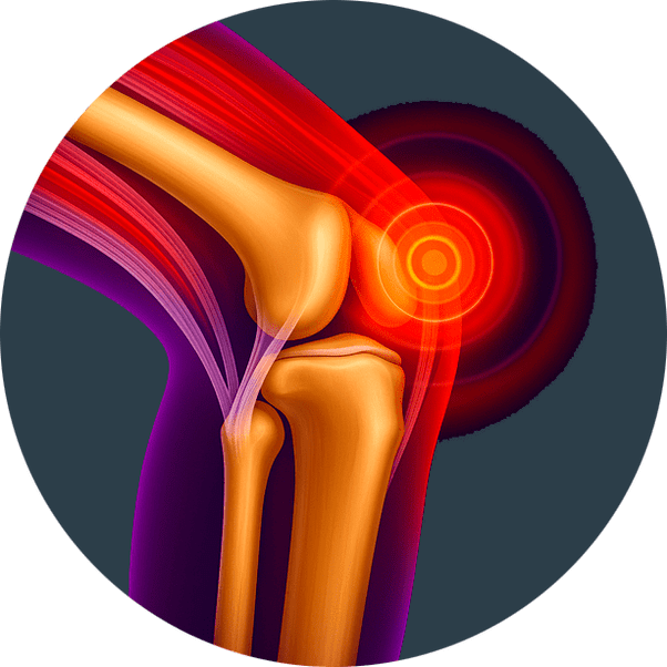 Inflammation articulaire